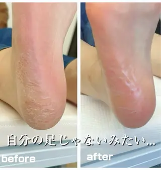 巻き爪フットケアサロンKotori所属・フットケアサロン Kotoriのその他イメージ