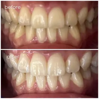 エクシア津駅前店所属・セルフホワイトニング エクシア津駅前店のその他イメージ