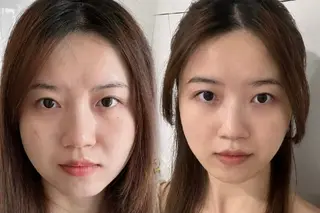 aliaハイフ&水光ジェットサロン所属・aliaハーブ水光店 エステティシャン募集のエステ・リラクイメージ