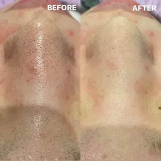 ショート カラー パーマ ヘアアレンジ メンズ キッズ ネイル マツエク・マツパ NANI OAFU所属・NANIOAFU [なんば店］のその他イメージ