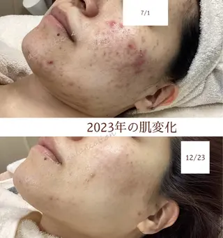 都度払い 肌質改善専門サロンのエステ・リラクイメージ