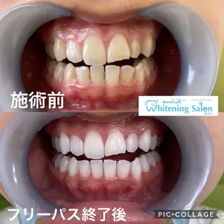 ホワイトニング&アイラッシュ四日市ホワイト所属・アイラッシュ ホワイトニング四日市のマツエク・マツパデザイン