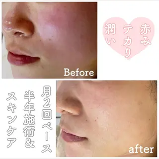 都度払い肌改善専門店 店長二上文香のエステ・リラクイメージ