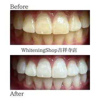 ホワイトニング ショップ吉祥寺店のエステ・リラクイメージ