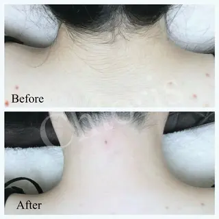 川越ローマピンク 光脱毛＆ワックス脱毛のエステ・リラクイメージ