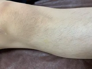 メンズ キッズ 脱毛SALON RaYNiCKのエステ・リラクイメージ