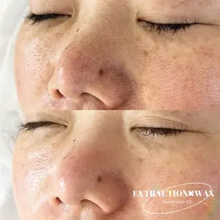 ワックス脱毛専門店 ICE  池袋の眉毛・アイブロウイメージ