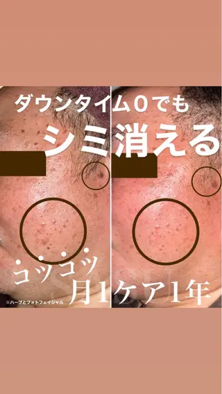 鍼灸×ハーブピーリングサロンSASU所属・石井 稚乃のその他イメージ