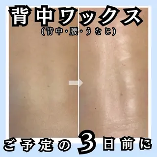 毛穴レス ハーブ& ワックス脱毛×光脱毛のエステ・リラクイメージ