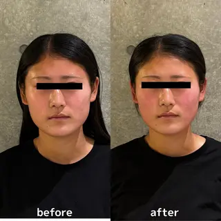 美容整体師 菅原力也 姿勢/小顔/目黒のエステ・リラクイメージ