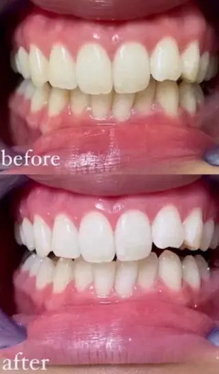 if_whitening柏原店所属・棟久 香澄のその他イメージ