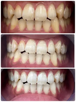 エクシアホワイト日本橋店所属・エクシアホワイト 日本橋／志村のその他イメージ