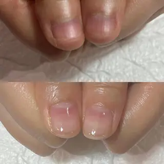 ネイル 自爪育成・巻き爪 補正講師　津蔵のネイルデザイン