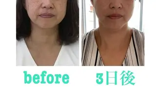 小顔と ヘッドスパのお店のエステ・リラクイメージ