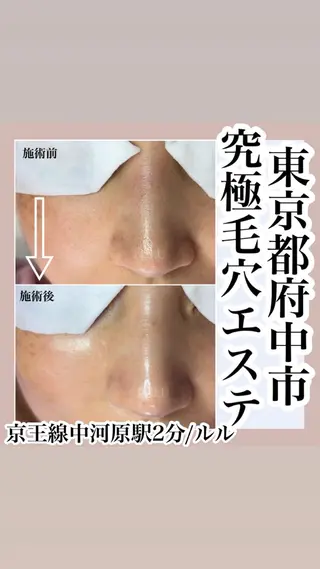 LULU所属・LULU ルルのエステ・リラクイメージ