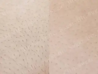 Hit. シュガーリング豊橋のエステ・リラクイメージ