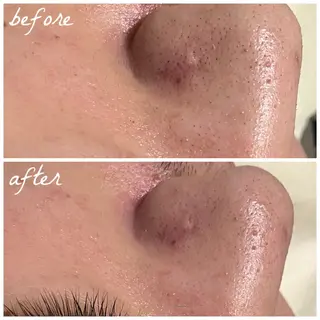 メンズ メナード岐阜市茜部 杉浦のエステ・リラクイメージ