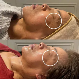 成宮鍼灸整骨院 & total  beauty  salon所属・中村 優美のエステ・リラクイメージ