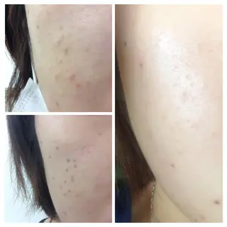 シミ・たるみ専門 サロン Cherieのエステ・リラクイメージ