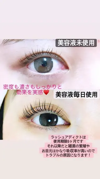 マツエク・マツパ Lotus.所属・Lotus. makoのエステ・リラクイメージ