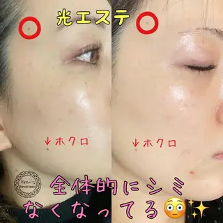 Rim リムのマツエク・マツパデザイン