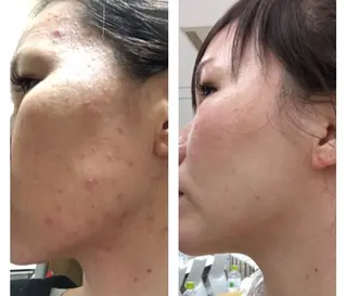 YOSAPARK八王子店所属・YOSAPARK 八王子店のエステ・リラクイメージ