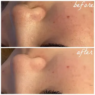 メンズ メナード岐阜市茜部 杉浦のエステ・リラクイメージ