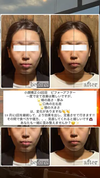 💎後悔させない小顔 矯正💎イトヤマ🌱のエステ・リラクイメージ