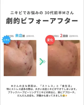 舟橋 優衣のエステ・リラクイメージ