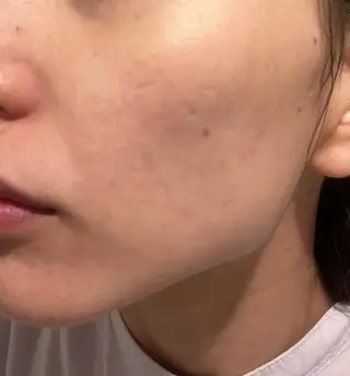 脱毛SALON RaYNiCKのエステ・リラクイメージ