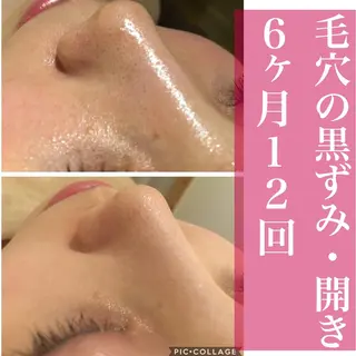 ミディアム カラー パーマ ヘアアレンジ メンズ キッズ ネイル マツエク・マツパ ニキビ・肌質改善専門 ♡人生が変わるサロンのエステ・リラクイメージ