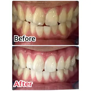 メンズ プラチナムビューティー柏所属・【歯科提携】柏ホワイ トニングスタイルのその他イメージ