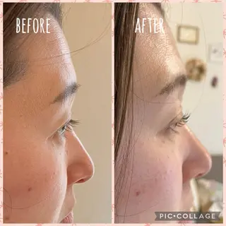 マツエク・マツパ Matricaria AKIのマツエク・マツパデザイン