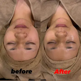 ルリアン　ガーデン所属・大山 彩能のエステ・リラクイメージ