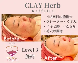 🌈Raffelia ラフェリア✨のエステ・リラクイメージ