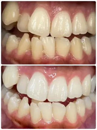 nail salon Na.(エヌエー)所属・nailsalon Na.のネイルデザイン