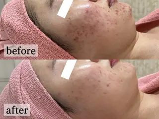 フェイシャル/脱毛 ジョアアンジェ竹田のエステ・リラクイメージ