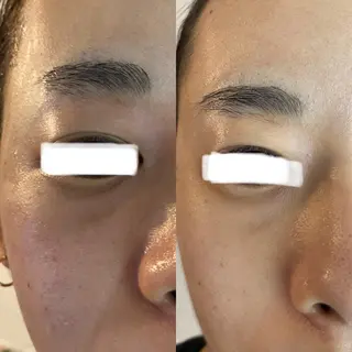 Meetite 小林のエステ・リラクイメージ