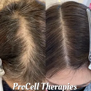 Ümit（ユミト） プロセルセラピーズのヘアスタイル