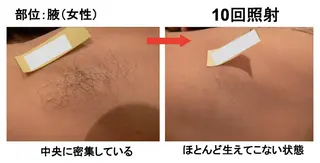 leolo武蔵浦和 肌質改善＆脱毛のエステ・リラクイメージ