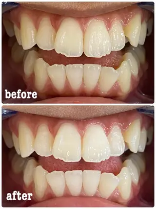 ホワイトニングサロン ラウレアのその他イメージ