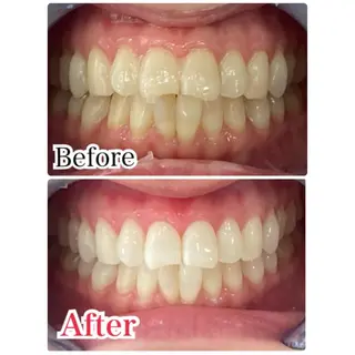 メンズ キッズ プラチナムビューティー柏所属・【歯科提携】柏ホワイ トニングスタイルのその他イメージ