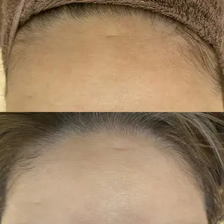 Meetite 小林のエステ・リラクイメージ