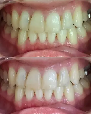 coco whitening＆Beauty所属・阿部 香織のエステ・リラクイメージ