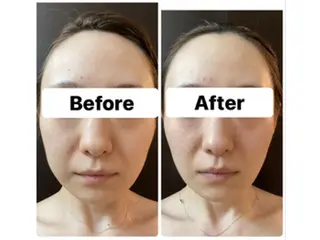 ハーブピーリング専門 muro.のエステ・リラクイメージ