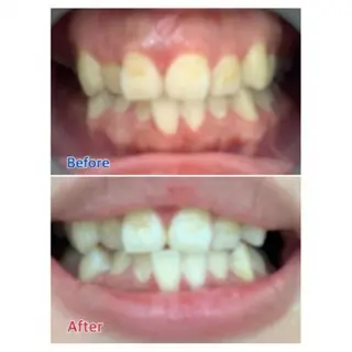 M渋谷店所属・M渋谷 ホワイトニングのエステ・リラクイメージ