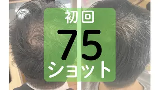 天使のしずく 神戸店所属・幹細胞エクソソーム 専門店 天使のしずくのその他イメージ