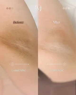 Chel チェルのその他イメージ