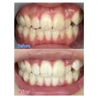 M渋谷店所属・Ｍ渋谷 ホワイトニングのその他イメージ