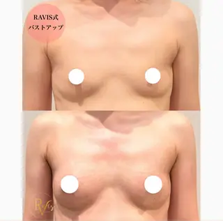 beautysalon RAVIS所属・東大阪/韓国肌管理/ 痩身バスト専門店のエステ・リラクイメージ